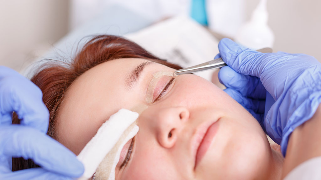 Femme en récupération post-blépharoplastie avec compresses froides sur les yeux